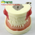 Oral Surgery Area Trainingsmodell Inzisionspus Removal Practice Model 12605